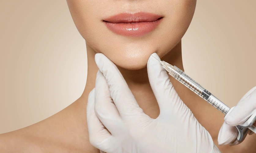 حقن الذقن بالفيلر
