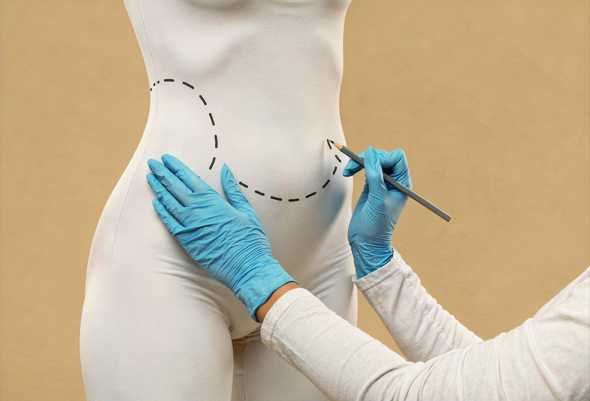 شفط الدهون بالفيزر