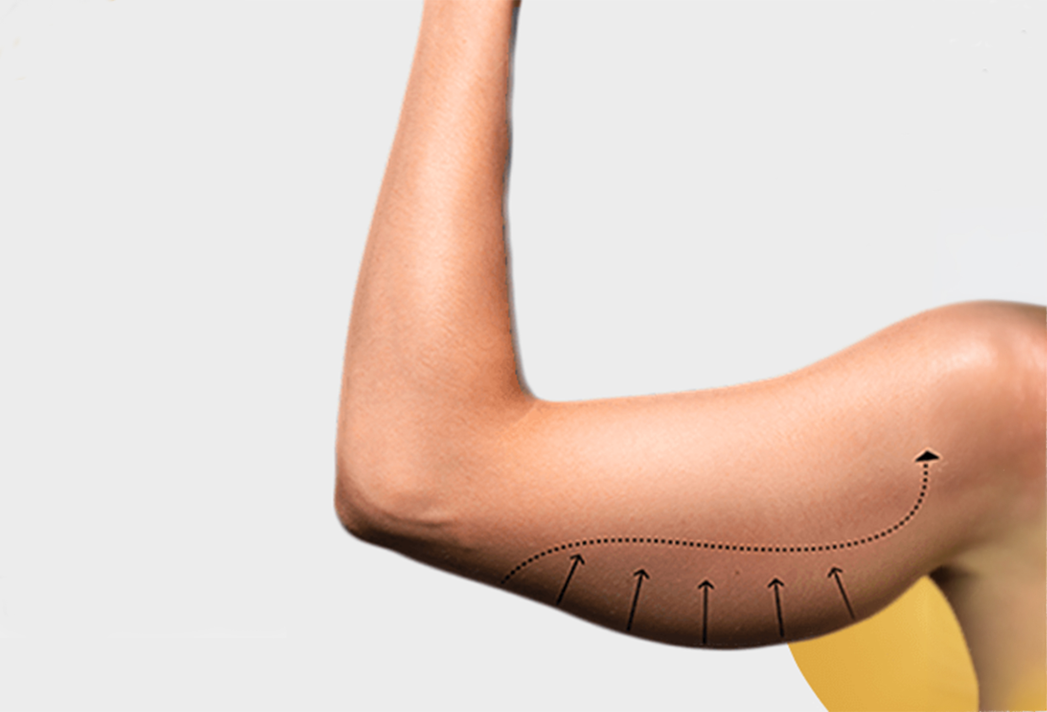 شد الذراعين