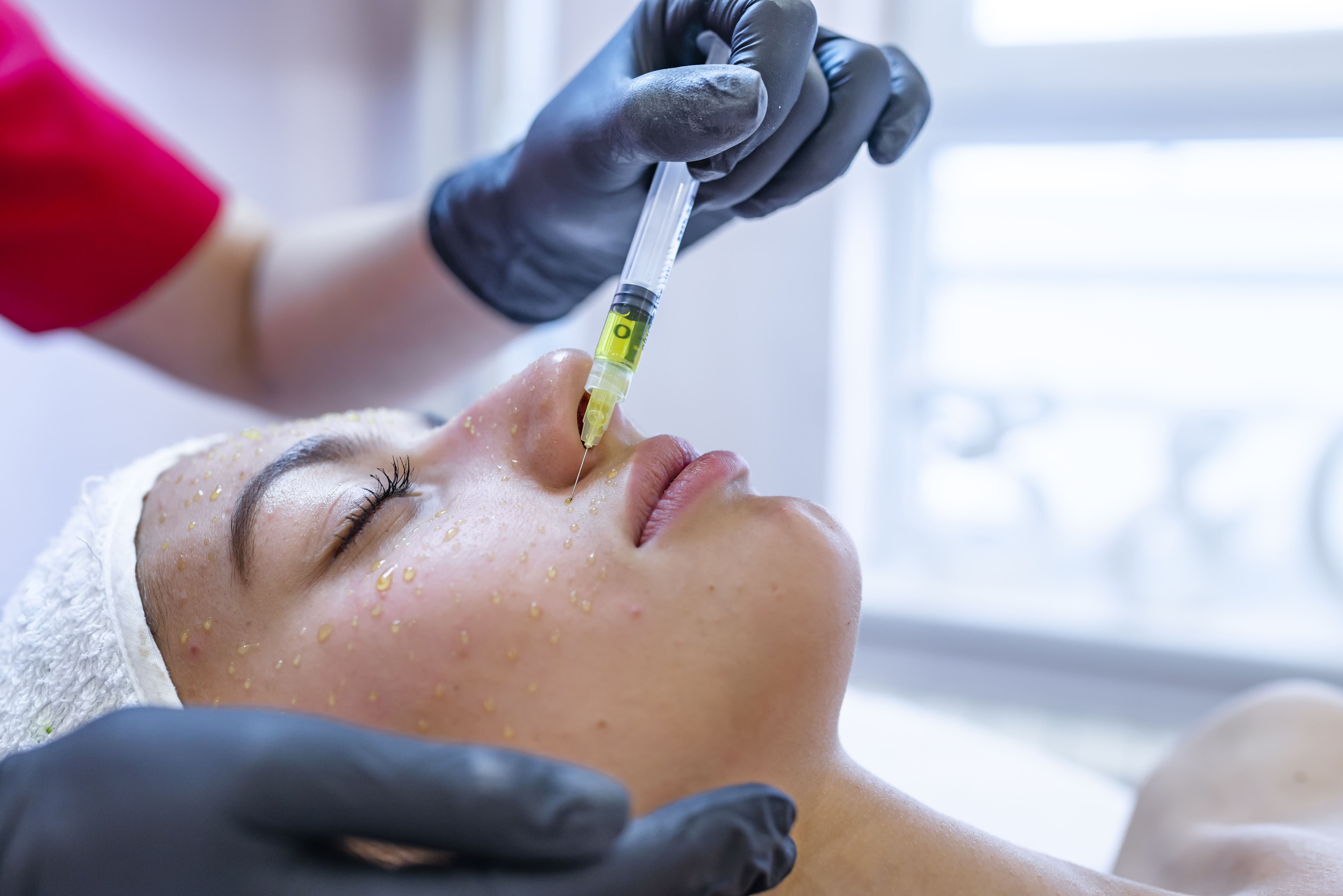 إبر النضارة